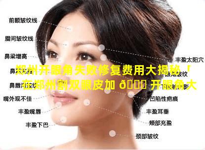 郑州开眼角失败修复费用大揭秘「在郑州割双眼皮加 🐎 开眼角大概多少钱」